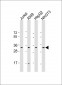 RPS2 Antibody (C-Term)